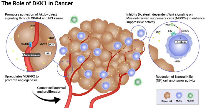 Sirexatamab（DKN-01）在臨床治療胃癌方面顯示出潛力