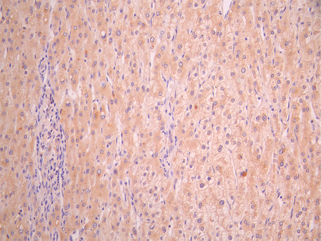 CSB-RA002873MA2HU IHC