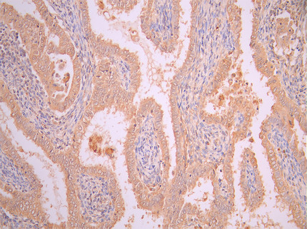 CSB-RA008424MA2HU IHC