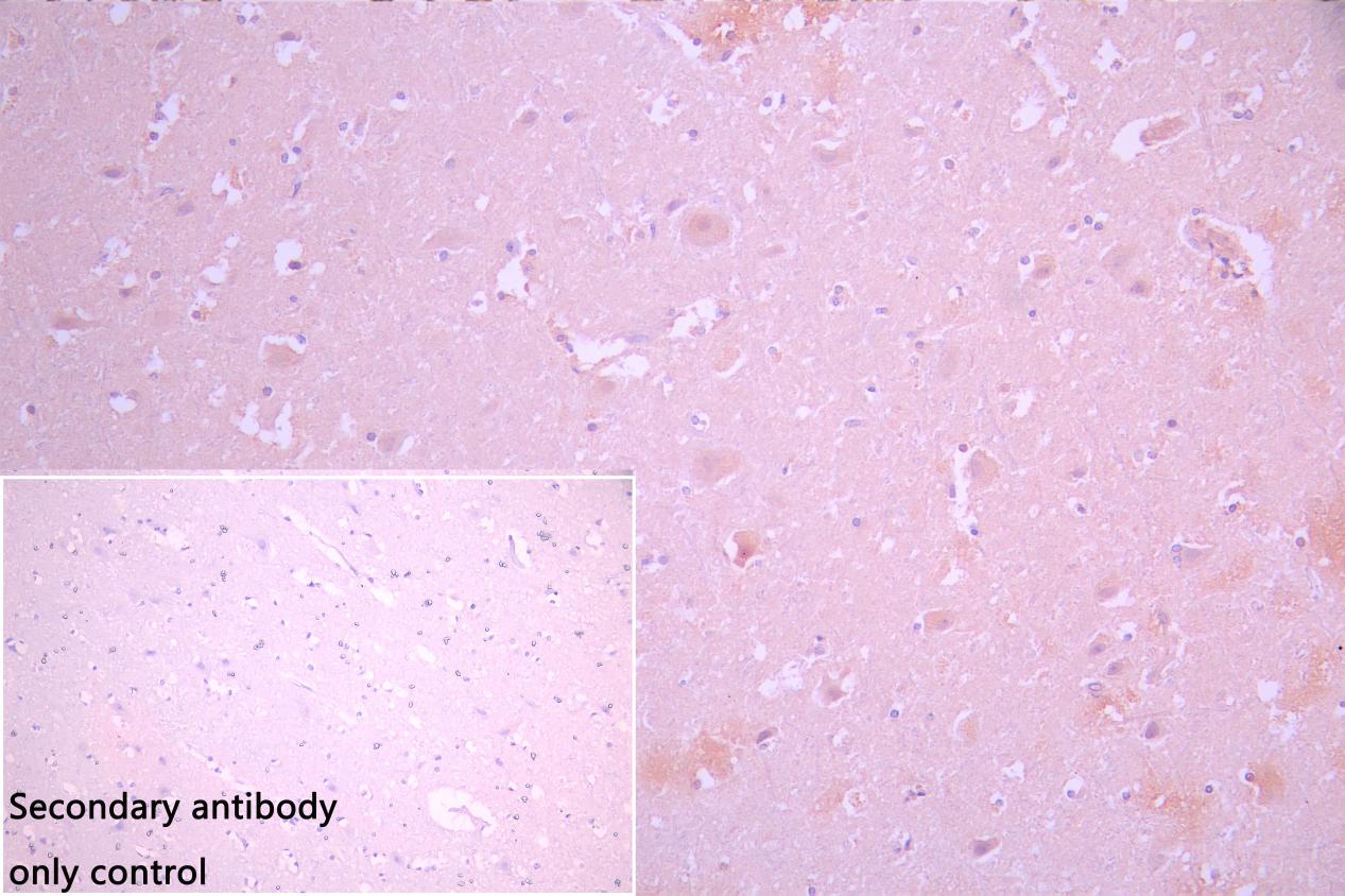 CSB-RA009369MA1HU-IHC