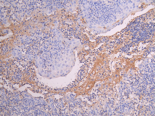 CSB-RA014679MA1HU IHC