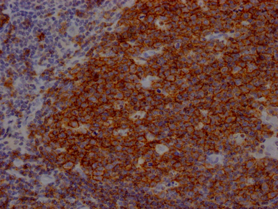 CSB-RA780821A0HU IHC