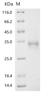 CSB-YP025630HU(F)(M)