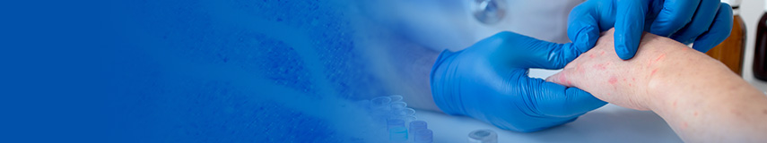 系統(tǒng)性紅斑狼瘡